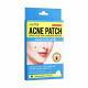 Sadoer Acne Patch 144s